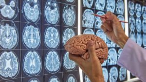 Neurocirujano en Cuernavaca